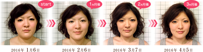 痛くない小顔矯正 | 大阪市中央区【美療骨salon 美-Balance 本町】